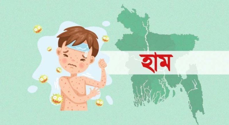 দেশে হাম ও উপসর্গে শিশু মৃত্যু সাড়ে ৩০০ ছাড়াল